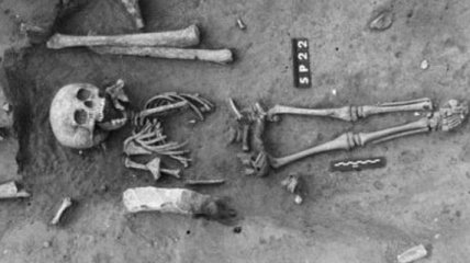 Найдены самые древние останки человека с синдромом Дауна