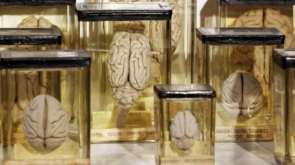 Великобритания передала в Бельгию коллекцию образцов человеческого мозга