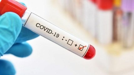 На Вінниччині - вже понад 450 інфікованих Covid-19