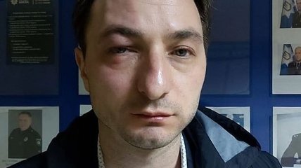 В Киеве избили главного врача Института рака