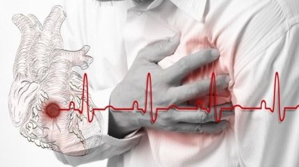 Группа крови влияет на риск инфаркта