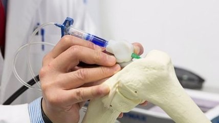 Биоручка позволит "дорисовывать" кости прямо во время операции