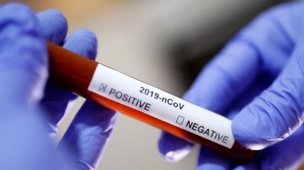 В "ЛНР" зафиксировали первый случай коронавируса