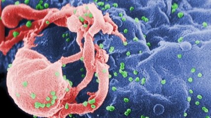 Ученые обнаружили геном, который способен защитить организм от ВИЧ