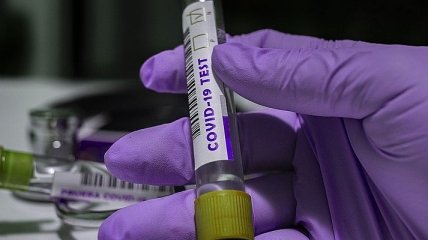 Эпидемия COVID-19: в Кировоградской области за сутки зарегистрировали 6 новых случаев