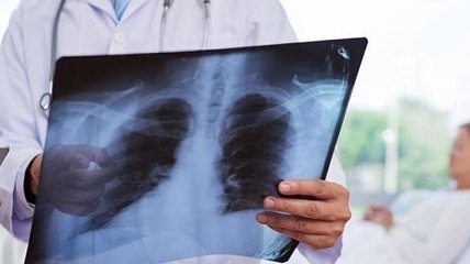 В Минздраве констатировали резкий рост больных пневмоний в Украине