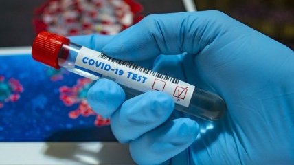 На Львівщині зафіксували вже 465 випадків захворювання на коронавірус
