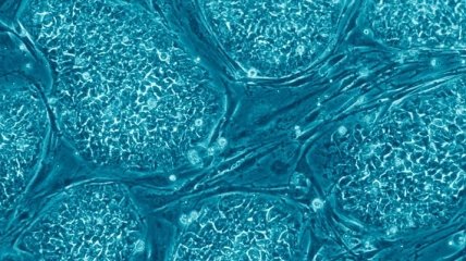 Ученые омолодили стволовые клетки человека 