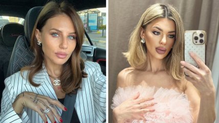 Анна Алхім та Олена Філонова нарвались на критику після примирення