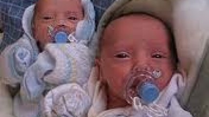 Однояйцевые близнецы не такие одинаковые, как считалось