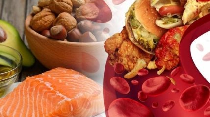 Хорошенько обдумайте свой рацион: продукты, снижающие холестерин