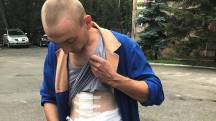На Львовщине солдату удалили селезенку после избиения офицером