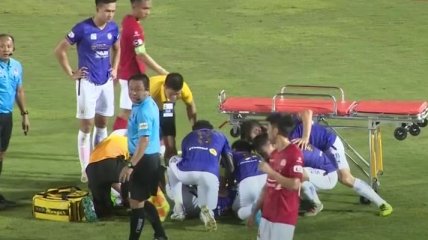Капитану национальной сборной сломали ногу во время матча (видео)