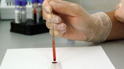 В Украине утверждены стандарты лечения ВИЧ по стандартам ВОЗ