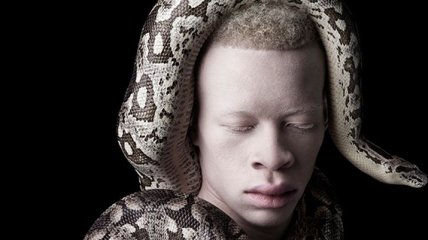 Южноафриканский фотограф делает потрясающие фотографии альбиносов 
