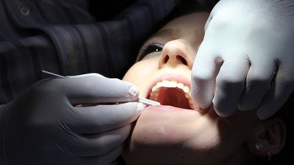 Кривые зубы могут быть опасны для вашего здоровья