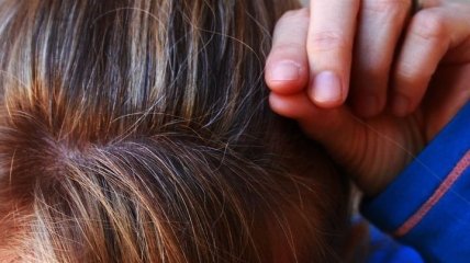 Седые волосы: причины появления ранней седины