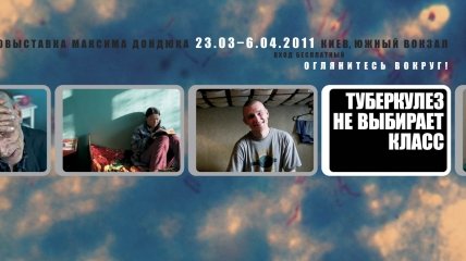 Завтра в Киеве откроется фотовыставка, посвященная проблеме туберкулеза