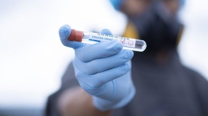 За добу в Україні 418 нових випадків коронавірусу