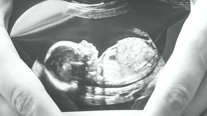 "Теряем" до рождения: у человеческого эмбриона присутствуют мышцы животных