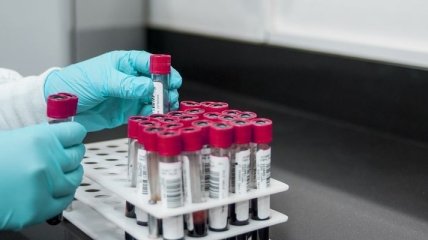 На Житомирщине еще 28 человек заболели коронавирусом