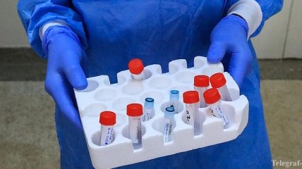 Германия проводит тестирование украинских препаратов против коронавируса