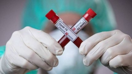 Помогла не вакцинация: эксперт объяснил снижение заболеваемости COVID-19 в США