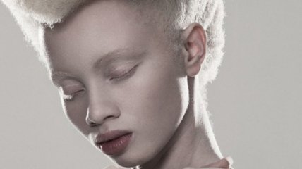 Южноафриканский фотограф разрушает суеверия, чтобы помочь альбиносам (Фото) 