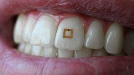 В США ученые изобрели мини-датчик на зуб для анализа еды