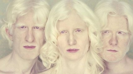 Не такие как все: необычная красота людей-альбиносов (Фото)