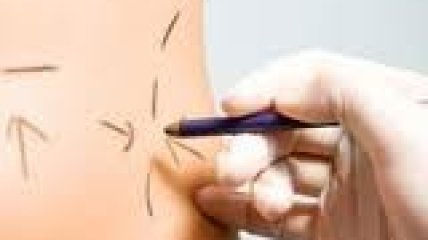 На школьных каникулах - под нож хирурга