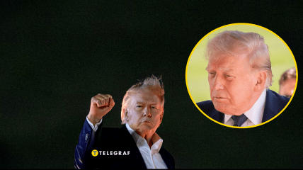 Дональд Трамп начал стремительно терять волосы