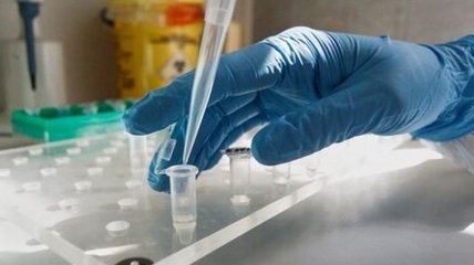 У Львівській області за добу на коронавірус захворіли 115 осіб