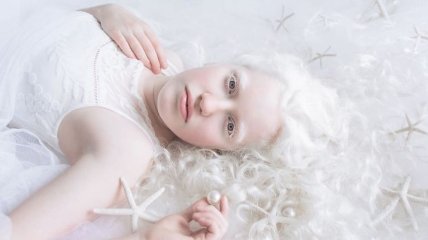 Потрясающие снимки людей-альбиносов, которые хочеться пересматривать (Фото) 