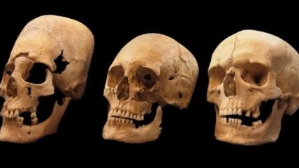 Ученые раскрыли секрет странных черепов средневековых европейских женщин 