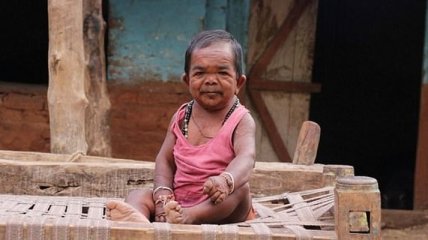 Самый маленький мужчина в Индии, которого легко принять за ребенка (Фото) 