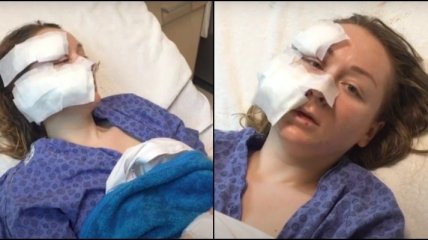 Ревнивый муж изрезал лицо молодой украинке прямо в торговом центре: подробности инцидента