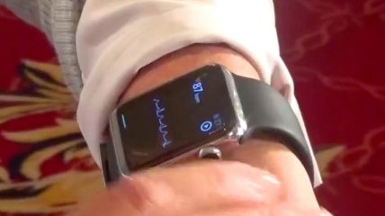 Новый ремешок для Apple Watch позволяет снимать ЭКГ (Видео)