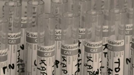 В Україні виготовили першу партію тестів на коронавірус
