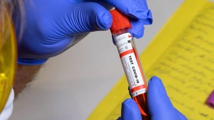На Буковине зафиксировали почти сотню новых случаев коронавируса