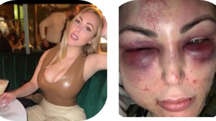 Экс-игрок российского клуба жестоко избил девушку: инцидент попал на видео