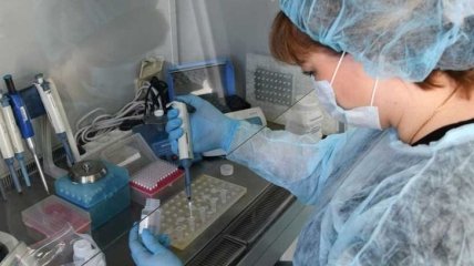 Українські вчені розробили тести для виявлення COVID-19 на ранній стадії
