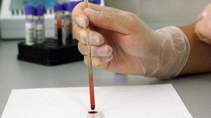 В Италии скончался второй человек от коронавируса