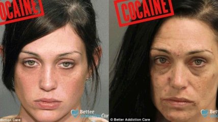 Лица наркозависимых до и после: как запрещенные вещества влияют на внешность (Фото)