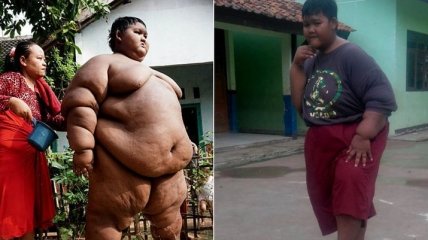 Самый толстый мальчик в мире похудел на 76 кг (Фото)