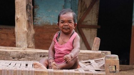 50-летний индийский "мальчик-с-пальчик" шокировал Сеть (Фото)