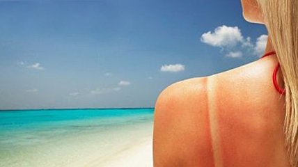 Почему ваша кожа обгорает на солнце
