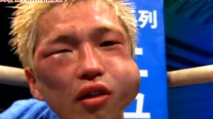 Бой, в котором Ригондо сломал челюсть японцу (Видео)