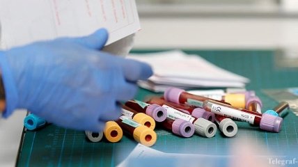 В Украине могут запустить массовое тестирование на антитела к коронавирусу