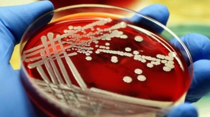 Ученые: Стафилококки "обманывают" антибиотики с помощью "ложных целей" 